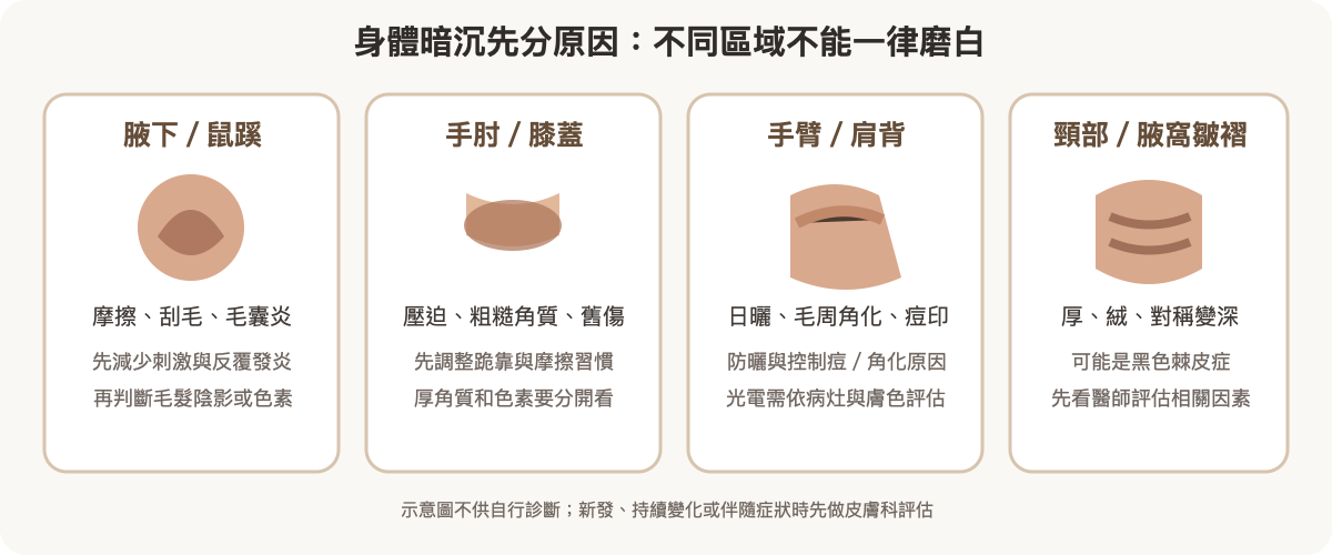 腋下、手肘膝蓋、手臂背部與皺褶處的暗沉線索與處理起點示意
