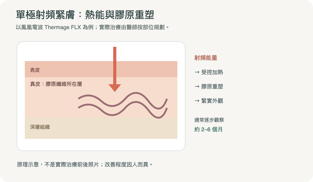 單極射頻加熱示意