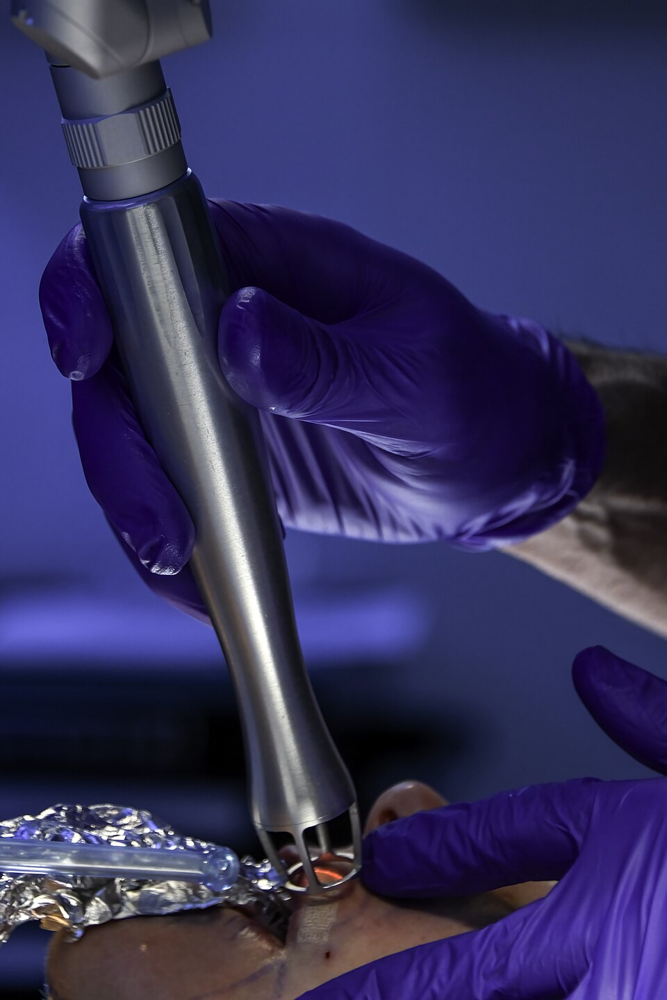 醫療人員以 CO₂ 雷射進行臉部表面療程的實際情境;照片僅示範另一類療程,不代表注射與雷射應同日安排