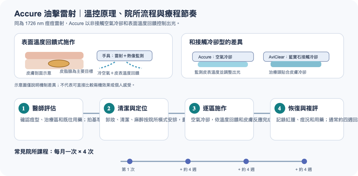 Accure 溫控原理、單次院所流程與常見每月四次療程示意