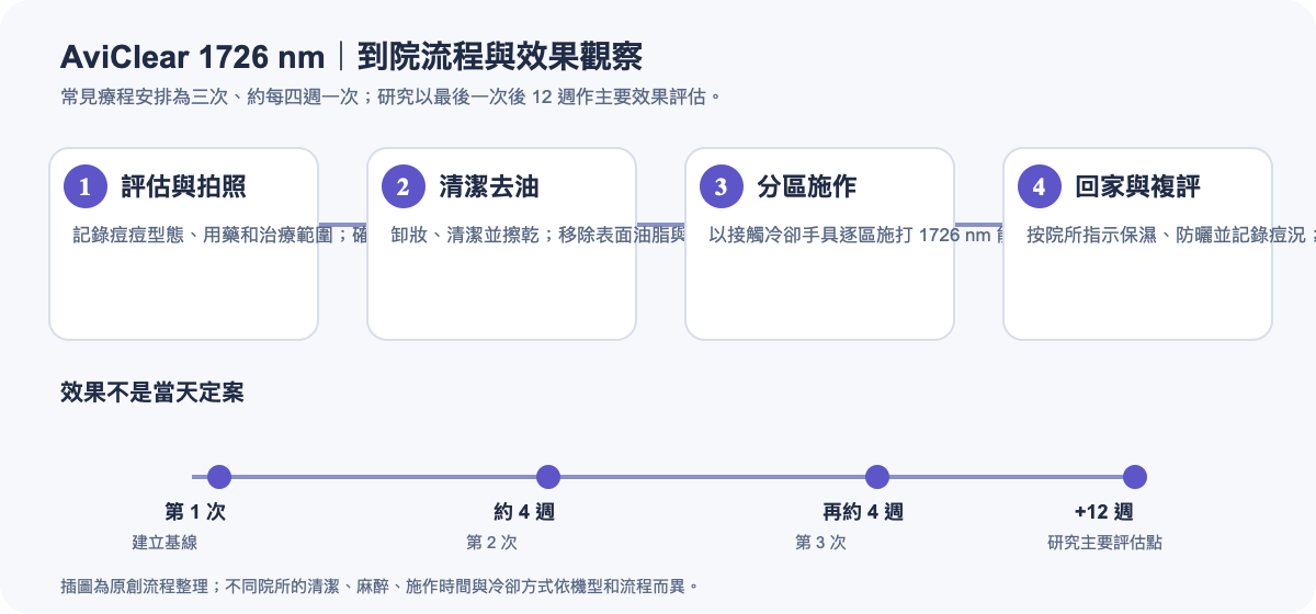AviClear 1726 nm 痘痘雷射到院流程與三次療程效果觀察時間軸