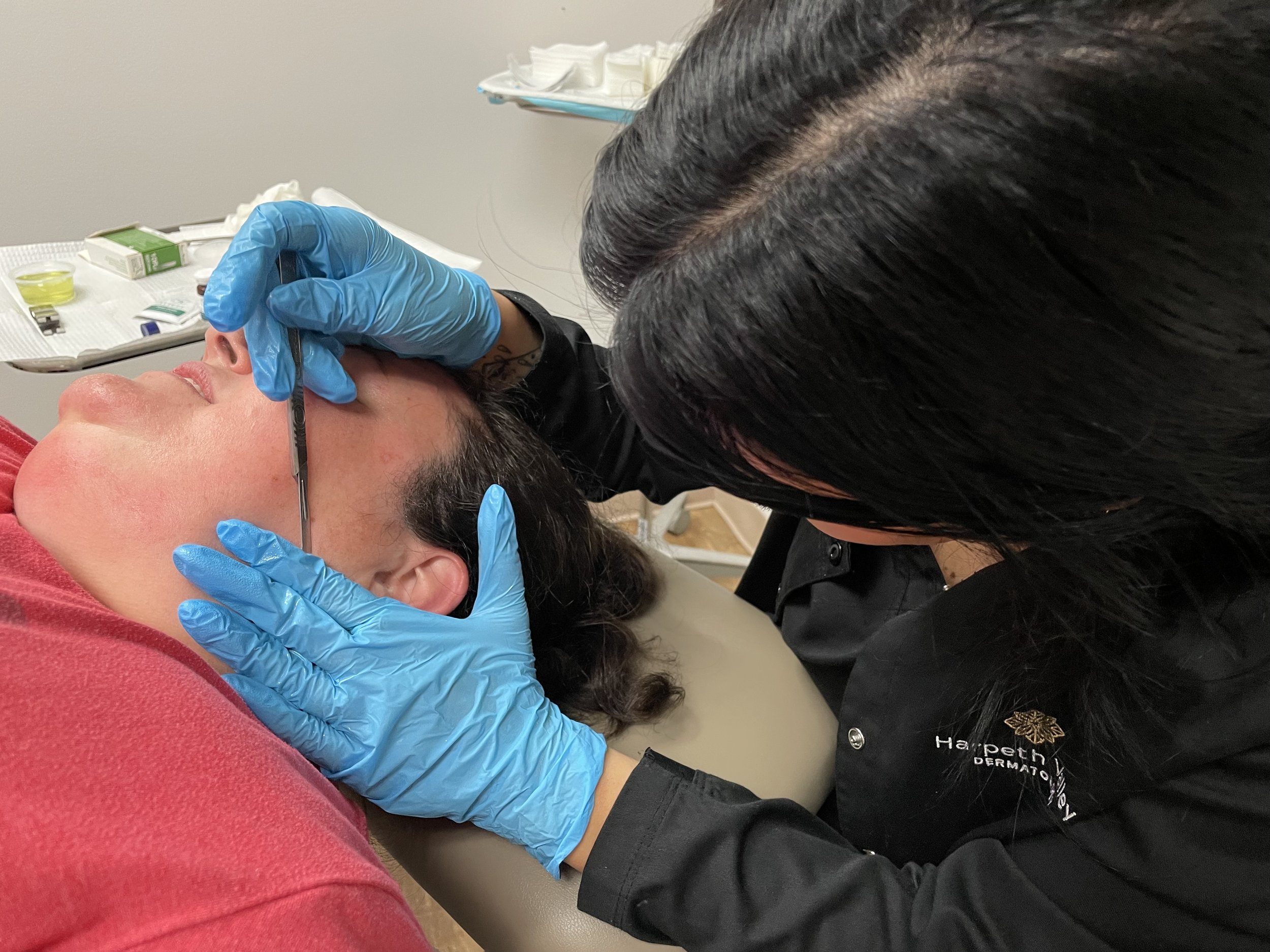 Harpeth Valley Dermatology 皮膚科診所的 Dermaplaning 專業刀片操作照