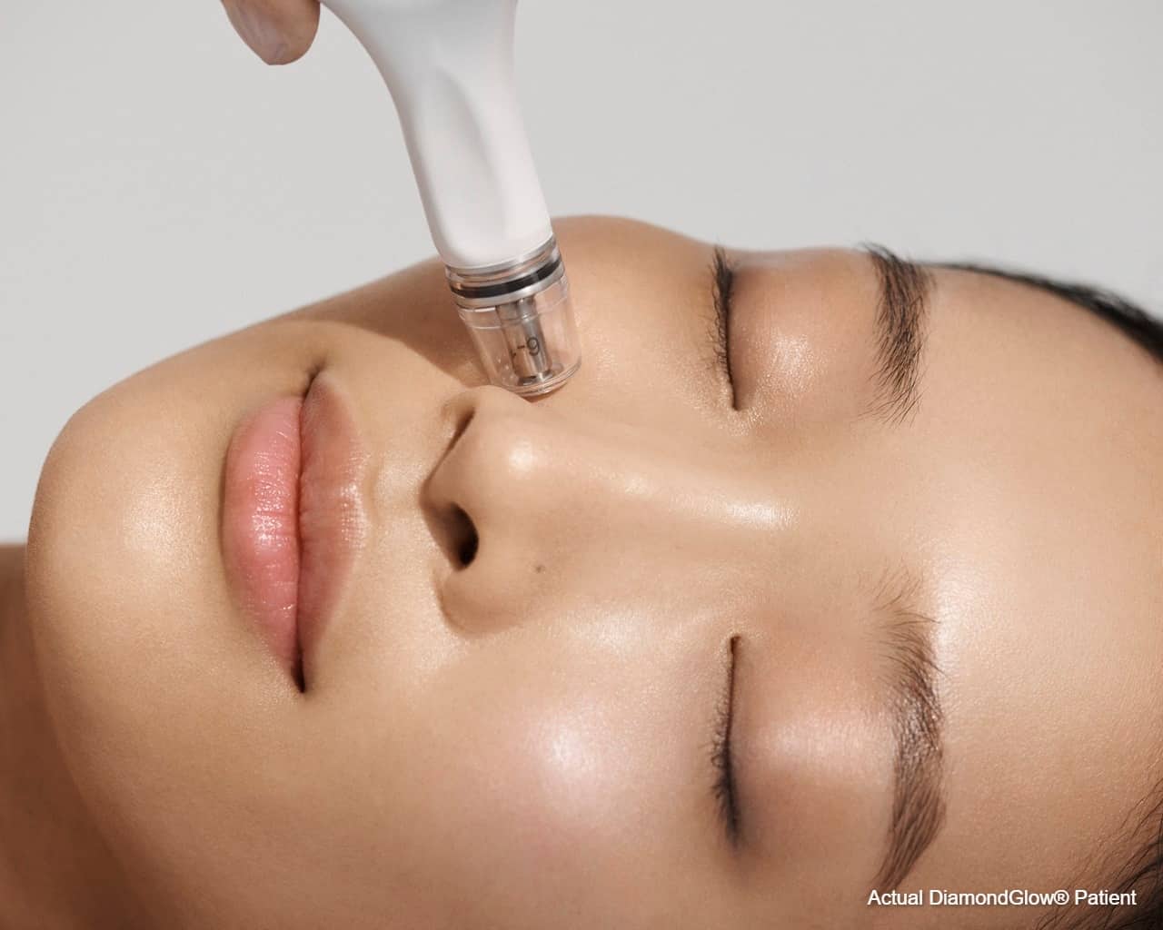 Clear Dermatology & Aesthetics Center 診間的 DiamondGlow 治療照
