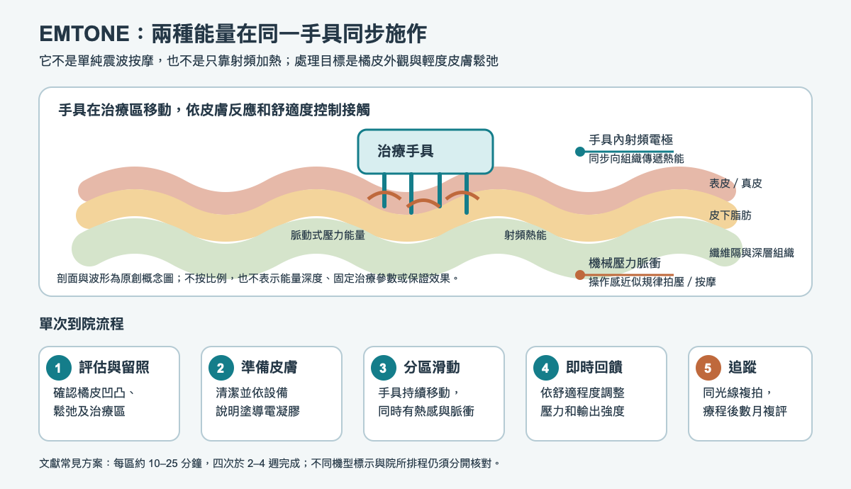 EMTONE 同步射頻與標靶壓力能量作用示意及到院流程