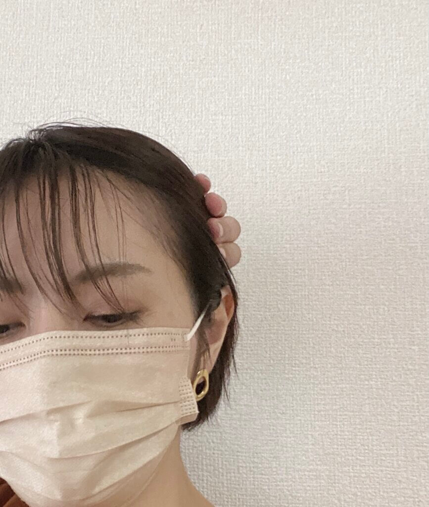 LEE 案例中側邊銜接不足的瀏海示例