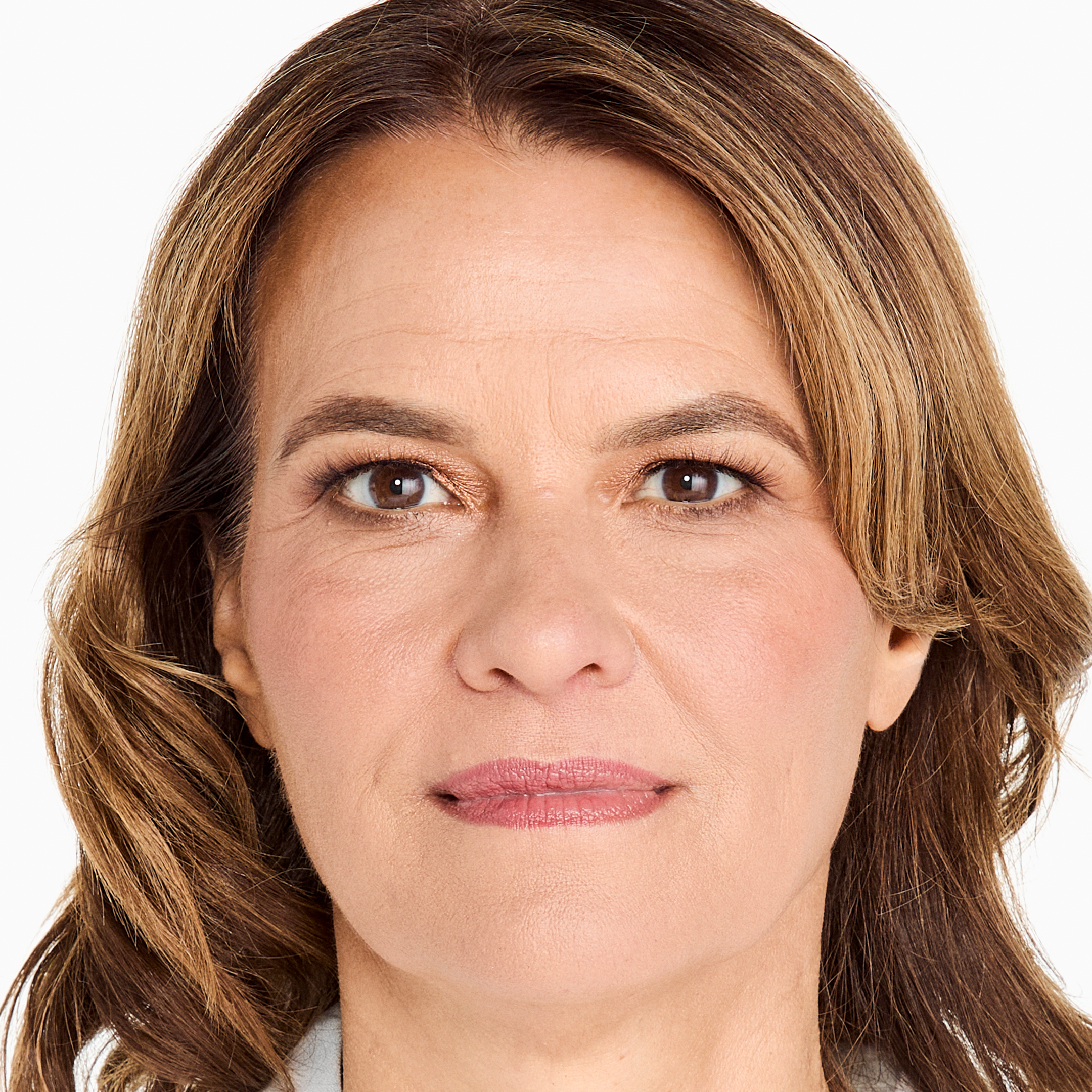 Ultherapy 官方案例治療前