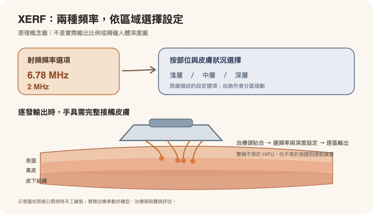 XERF 兩種射頻頻率與淺、中、深治療設定的手具示意圖