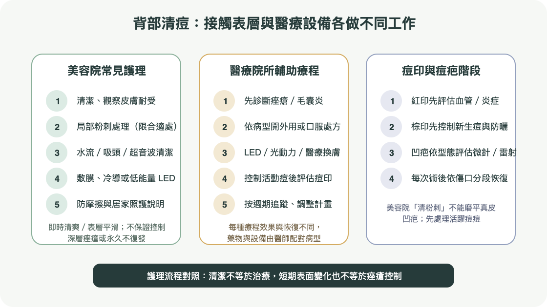 背部護理手法與醫療儀器流程比較：表層清潔、LED／換膚、醫療診斷及痘印處理的分工