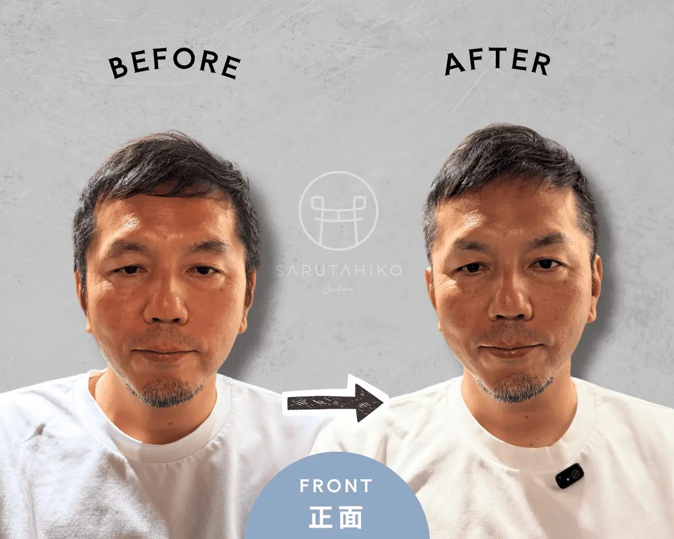 日本剪裁案例的正面 BEFORE/AFTER 原圖,用於補看頂部高度與前方輪廓
