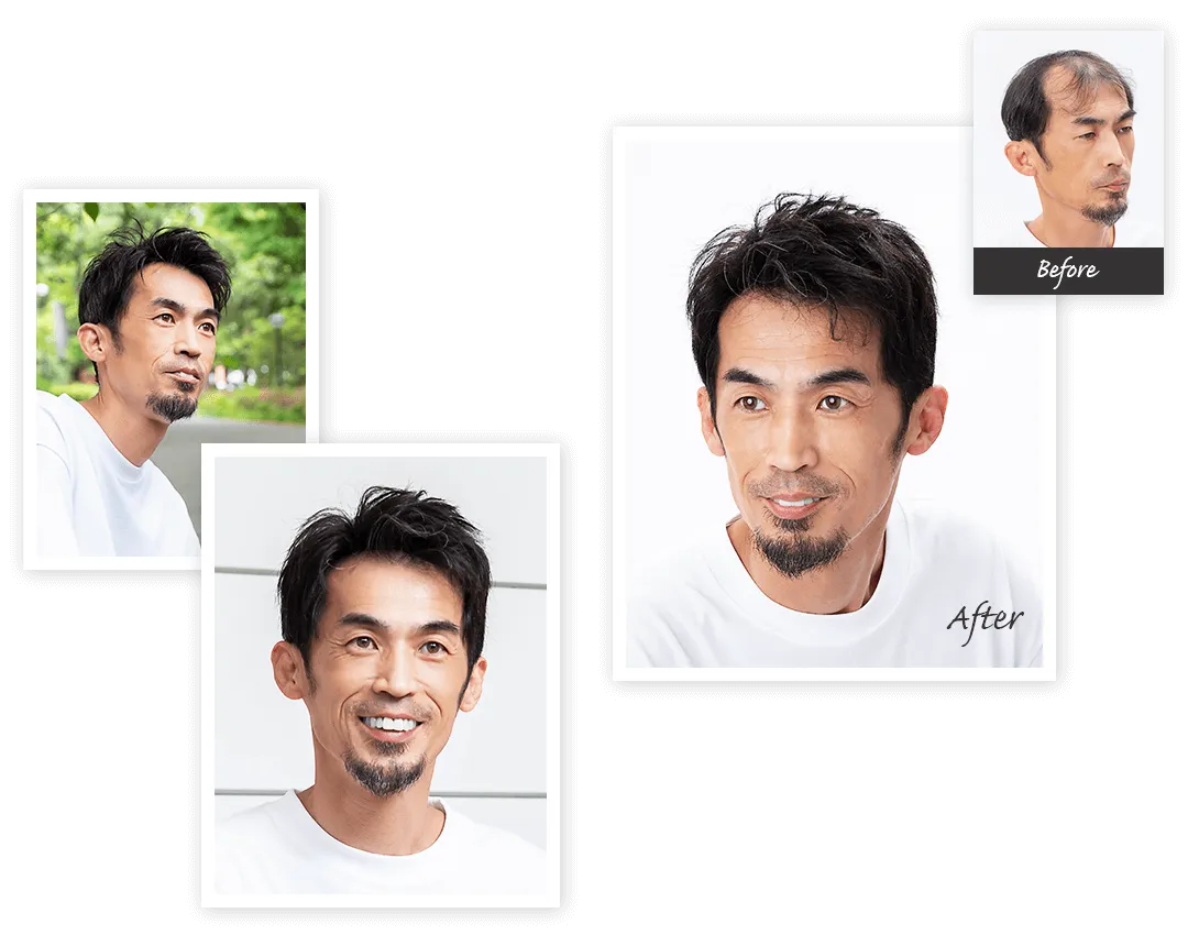 男士假髮造型案例:較成熟短髮輪廓示例,保留原圖的案例拼版
