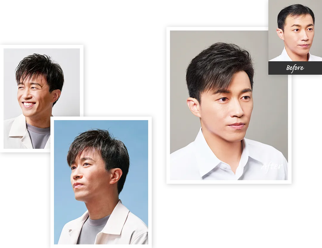 男士假髮造型案例:髮量補足後的短髮輪廓示例,來源為廠商案例圖