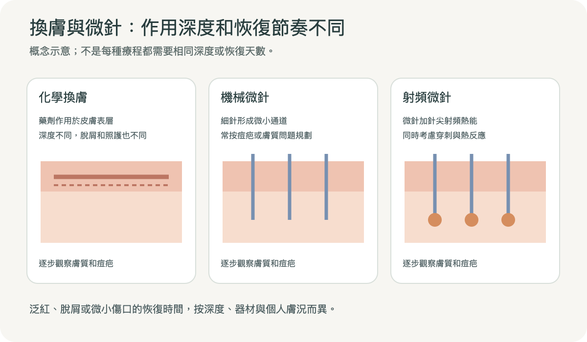 化學換膚、機械微針與射頻微針作用方式和皮膚層次示意;不是療效前後照