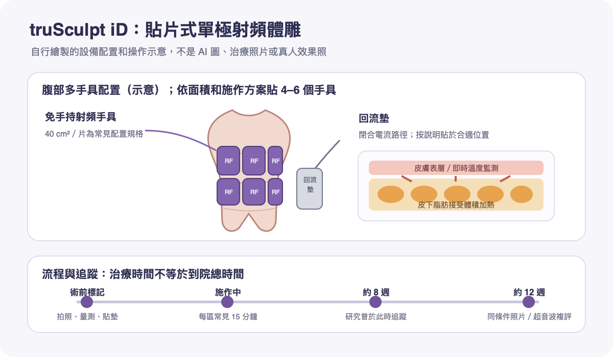 truSculpt iD 單極射頻多手具配置、回流墊及療程追蹤示意圖