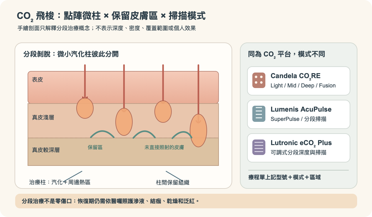 CO₂分段式雷射以點陣微小治療柱作用並保留周圍皮膚的手繪剖面示意