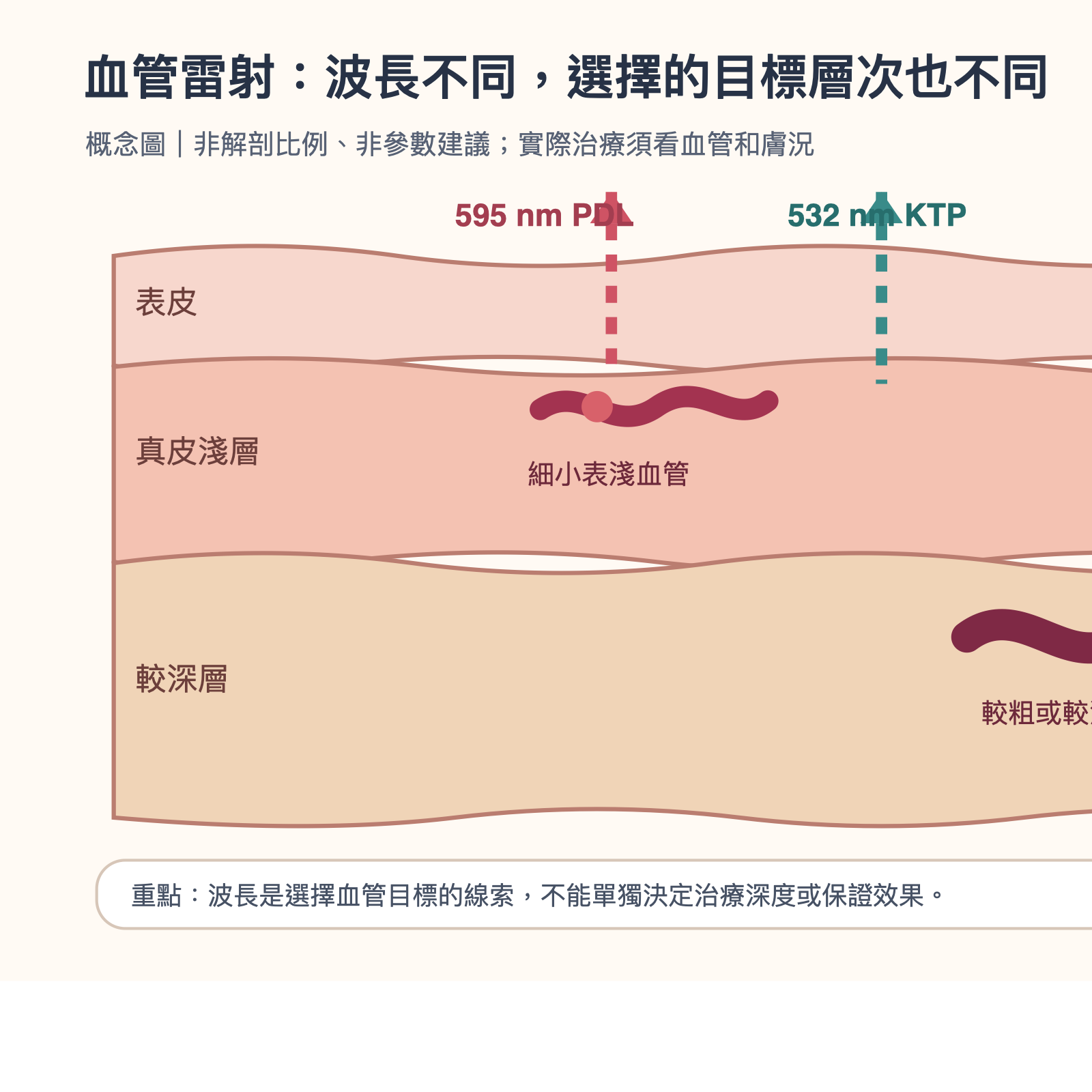 手繪示意:不同波長血管雷射在表淺與較深血管的作用位置