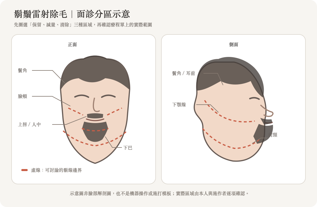 鬍鬚分區手繪圖：上唇、人中、下巴、臉頰、下顎線和前頸可分開規劃