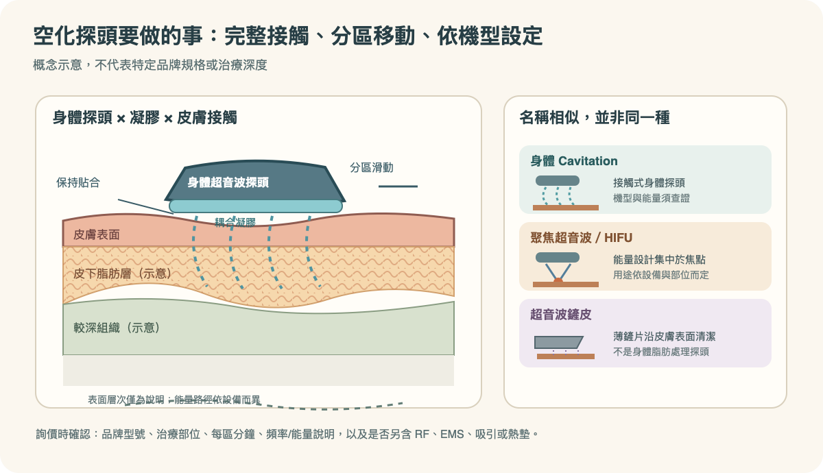 身體空化探頭、耦合凝膠與聚焦超音波的作用路徑手繪圖