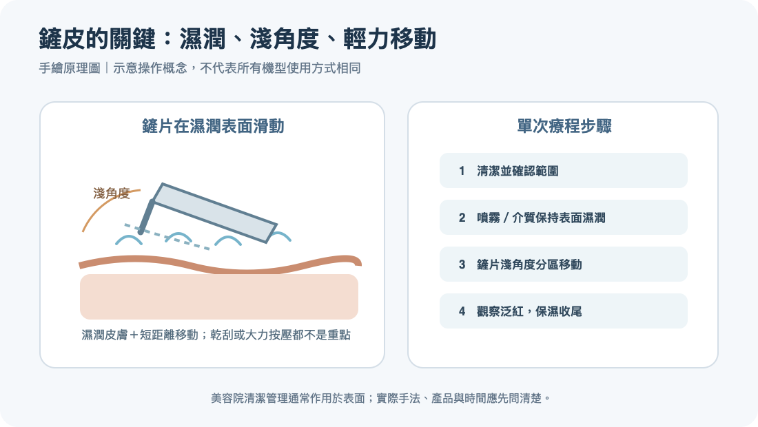 超音波鏟皮手具角度與操作路徑：濕潤表面、淺角度輕力滑動及療程步驟