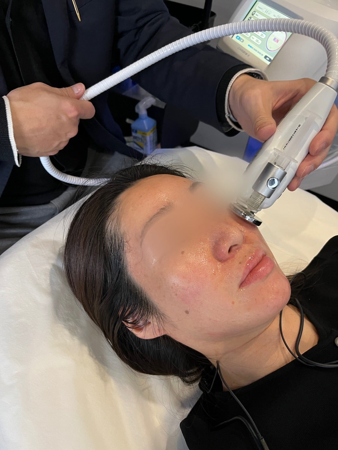 CareSys 電穿孔手具接觸臉部施作的實拍