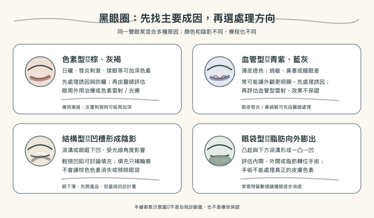 黑眼圈常見成因與對應處理方向手繪圖:色素、血管透色、淚溝陰影、眼袋膨出