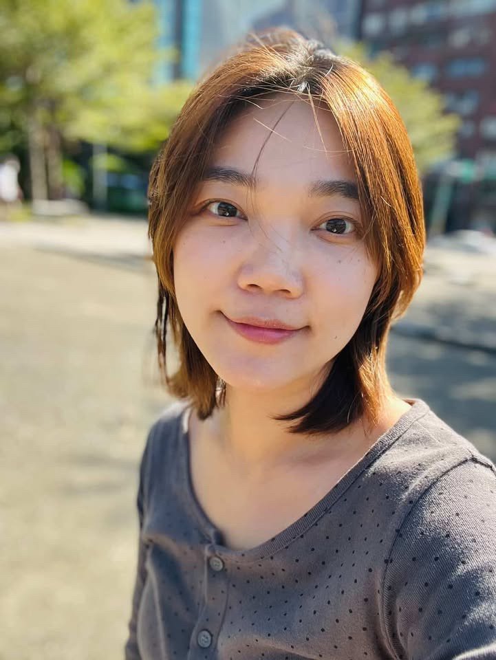 台灣院所公開個案:同一淚溝填充個案術後照片,已存入專案