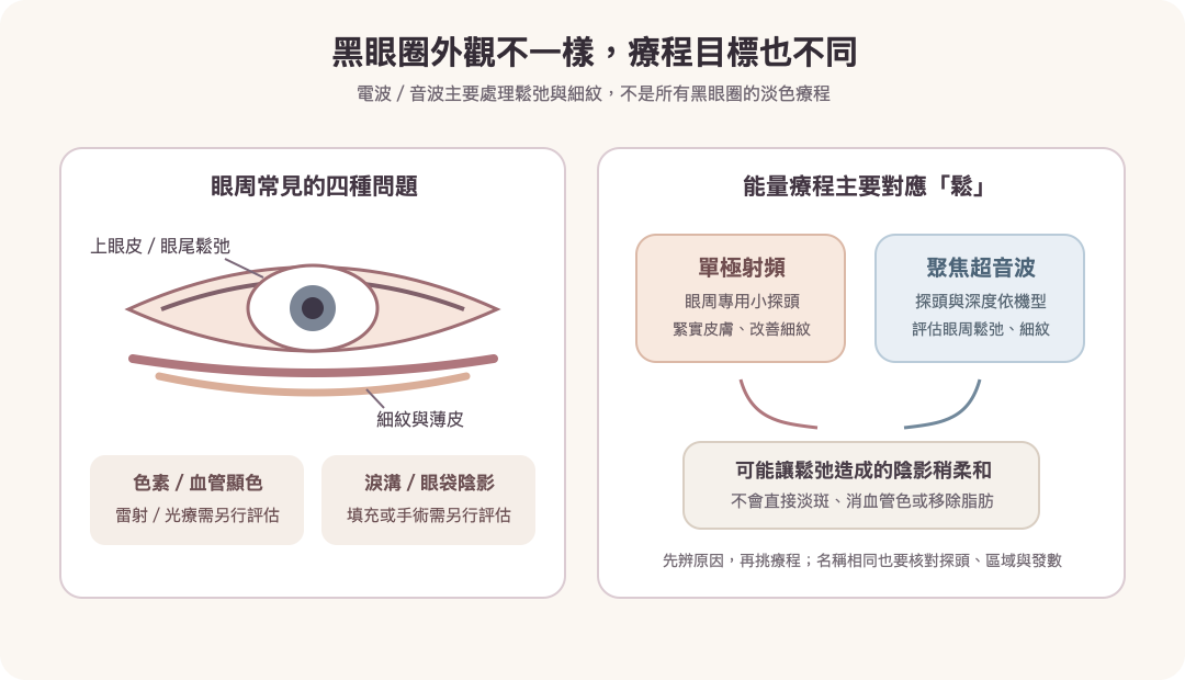 眼周鬆弛型黑眼圈的電波與音波作用目標,以及不直接處理的色素、血管原因